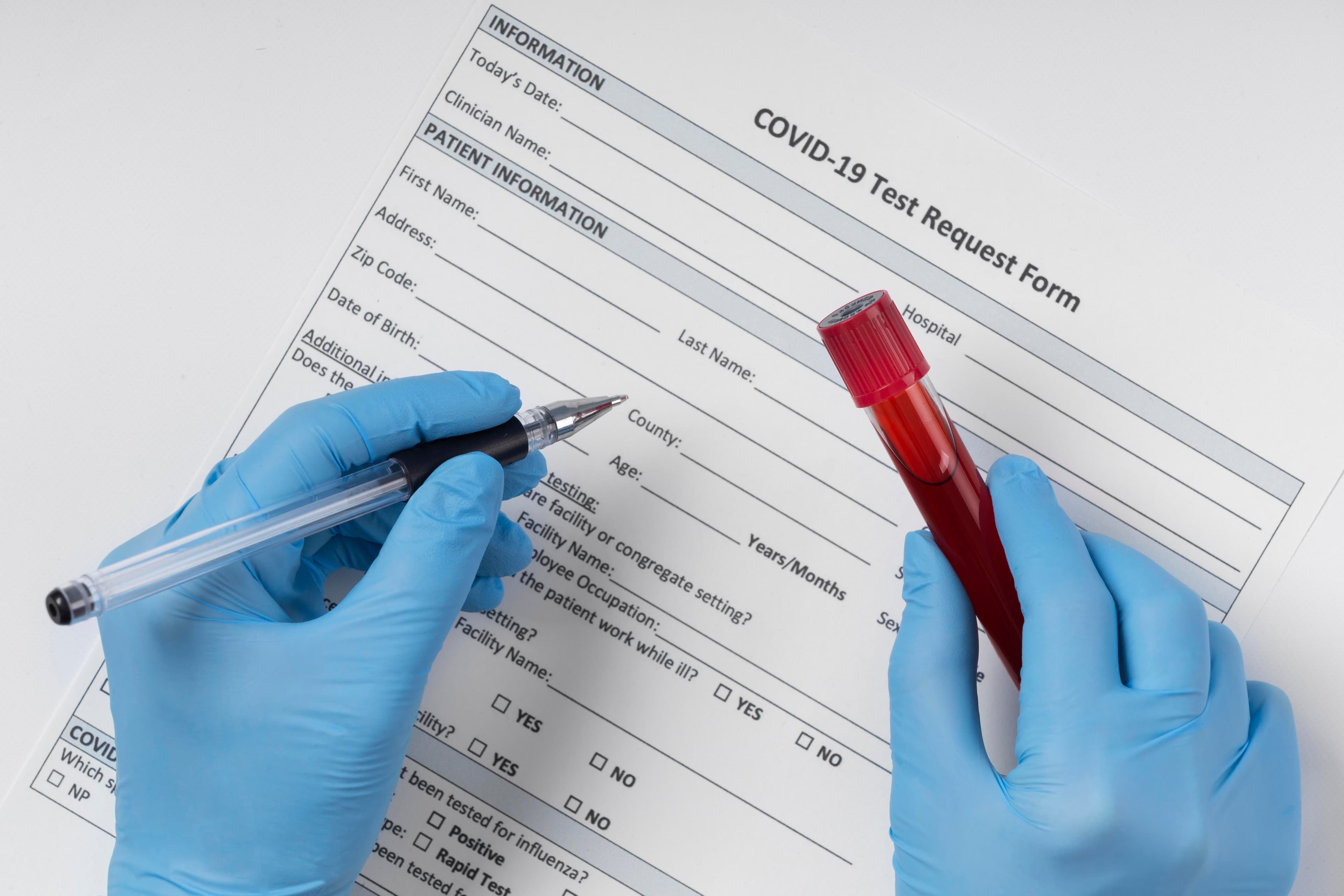 Ocu-HB vision : A non-invasive AI-Based Tool for Anaemia Screening