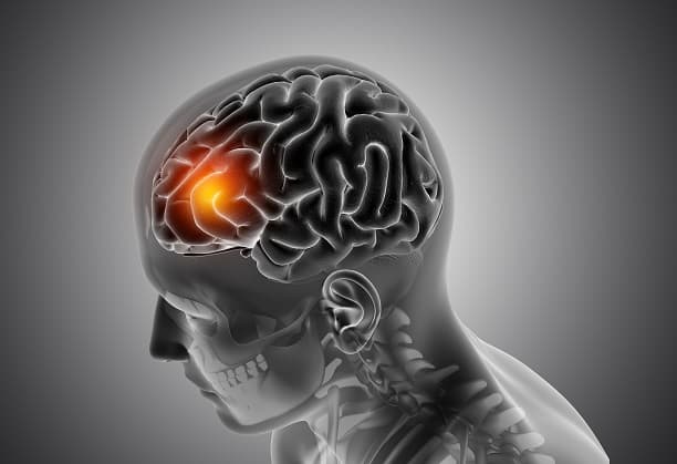 Whole Tumour Histology and Spatial transcriptomics for brain tumours in the Indian population