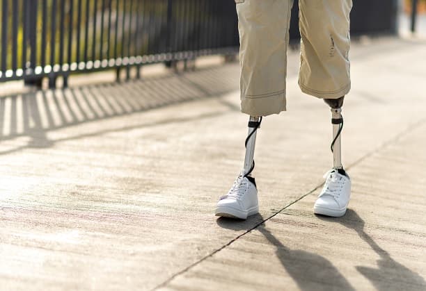Enhancing IIT Madras' Global Presence in Prosthetics Technologies