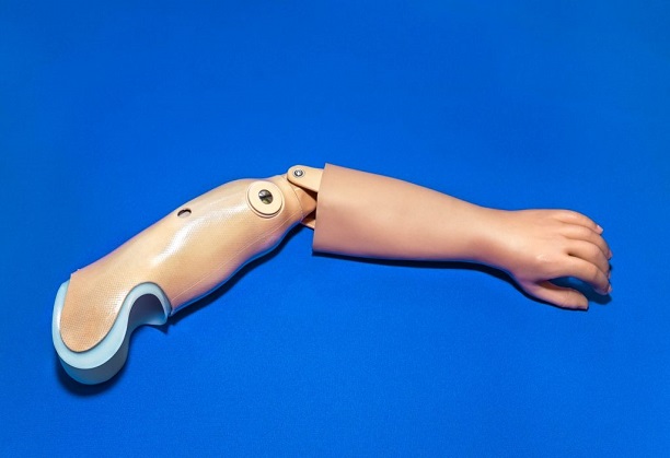 Project Jafar - Design of an affordable pediatric prosthetic arm for activities of daily living